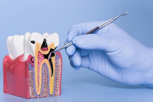 Tổng hợp 15 bệnh lý răng miệng dễ mắc phải hiện nay và cách phòng tránh