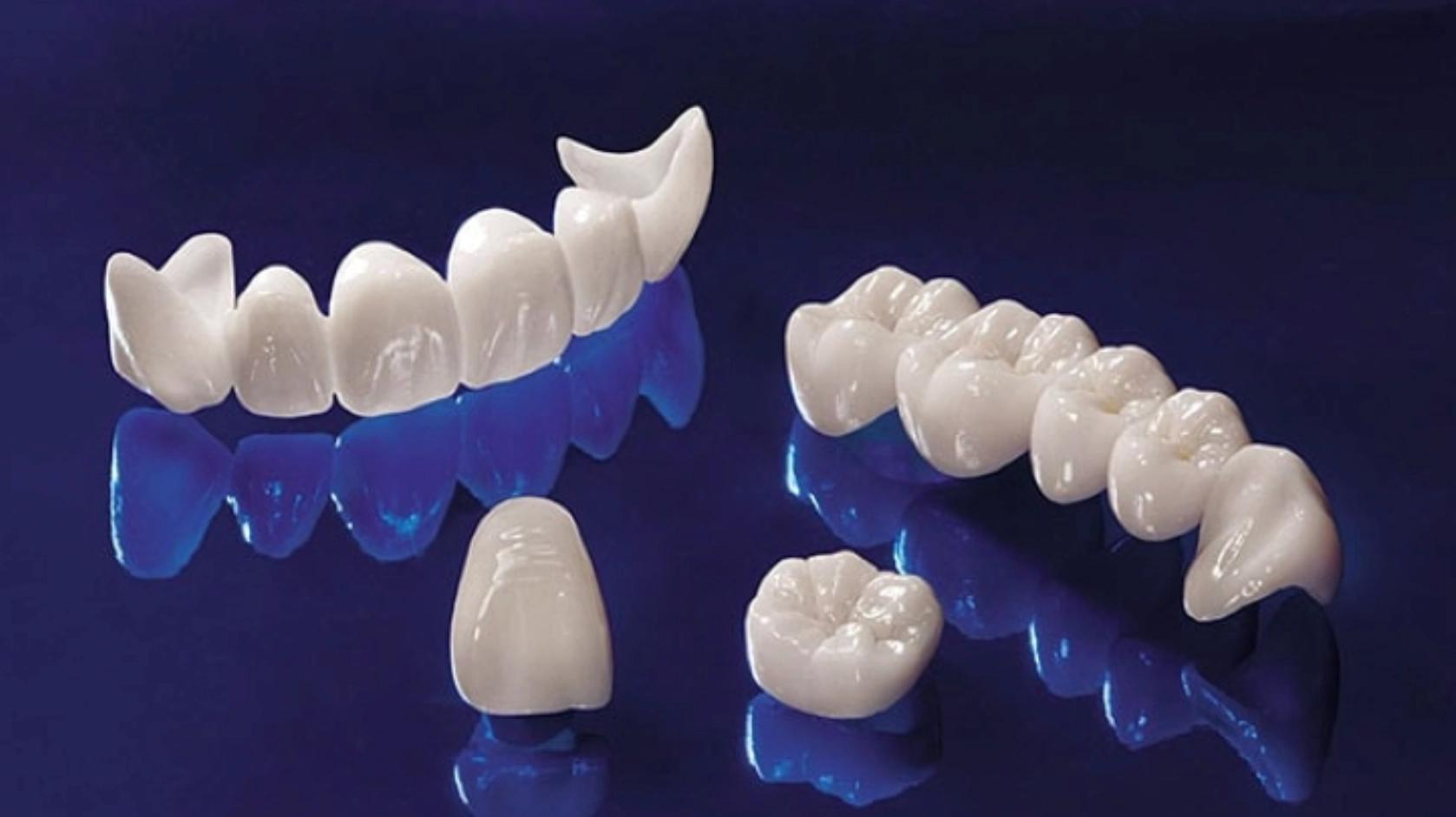 Bọc răng sứ Titan là gì? Có tốt không? Có mấy loại?