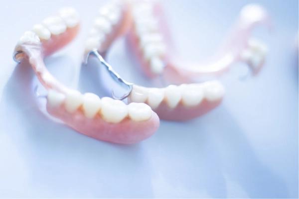 Hàm giả tháo lắp bất tiện? Trồng răng Implant - giải pháp phục hồi răng cố định, thoải mái