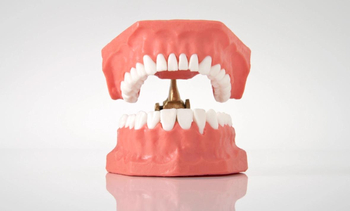 Răng giả tháo lắp phù hợp với ai? Ưu nhược điểm cần biết 