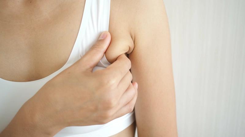 Hút mỡ nách: Xóa mỡ thừa kém duyên, lấy lại vùng nách mịn màng