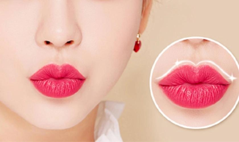 Tạo hình môi - Giải pháp cho đôi môi đẹp tự nhiên, cân đối và cuốn hút