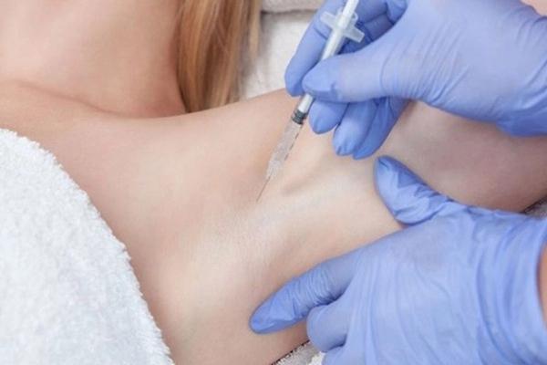 Tiêm Botox trị hôi nách: Giải pháp khử mùi an toàn, hiệu quả