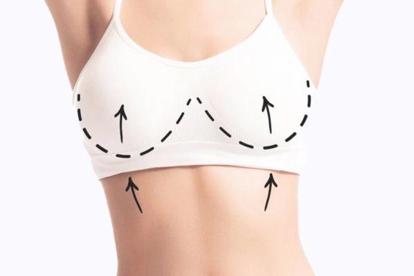 Treo sa trễ đường quầng: Cách lấy lại vòng một quyến rũ