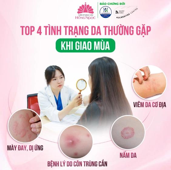 Viêm da cơ địa: Triệu chứng, tác hại và cách phòng ngừa