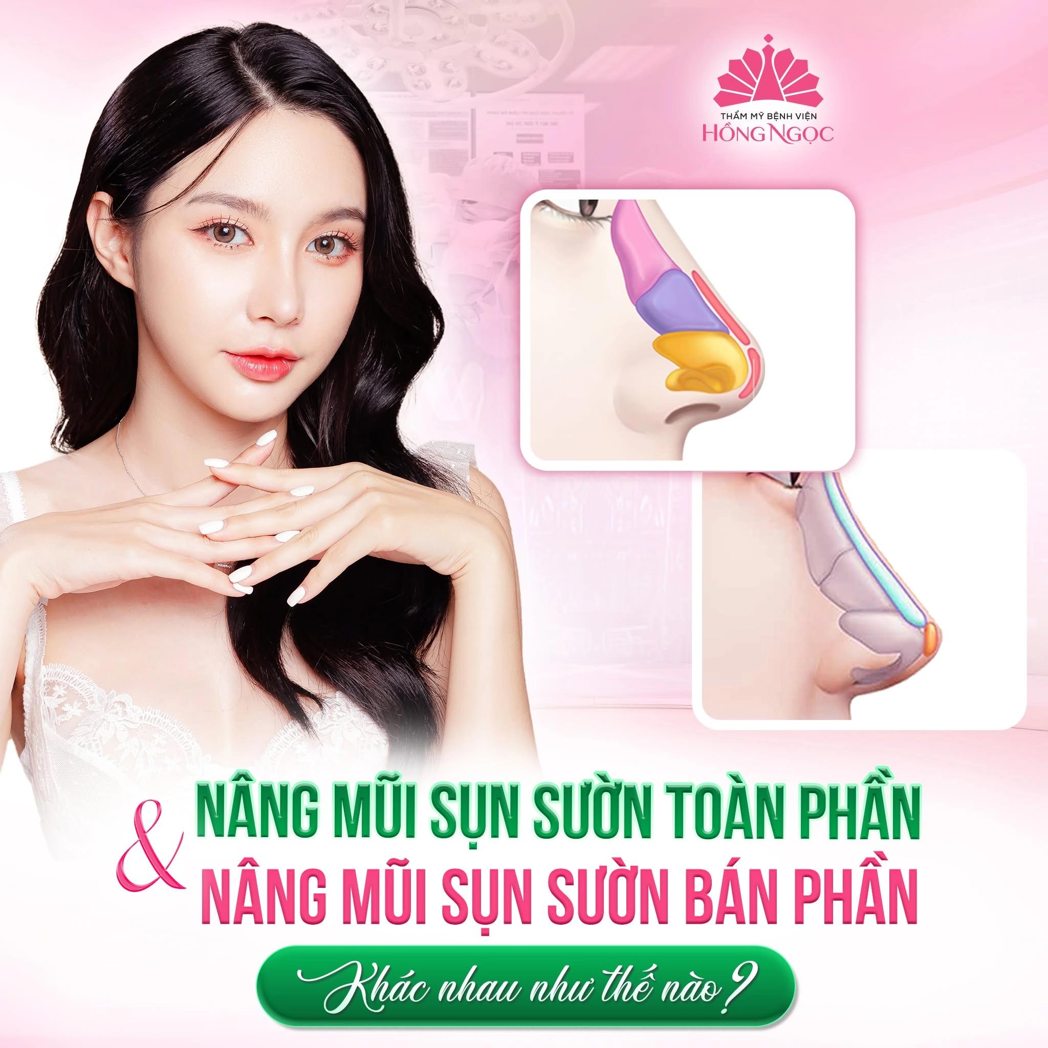 Nâng mũi sụn sườn giá bao nhiêu? Chi phí và những điều cần biết