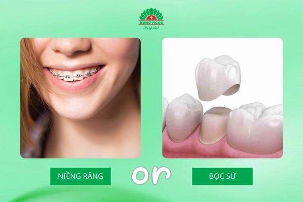 Niềng răng hay bọc răng sứ? Lựa chọn nào phù hợp cho bạn?