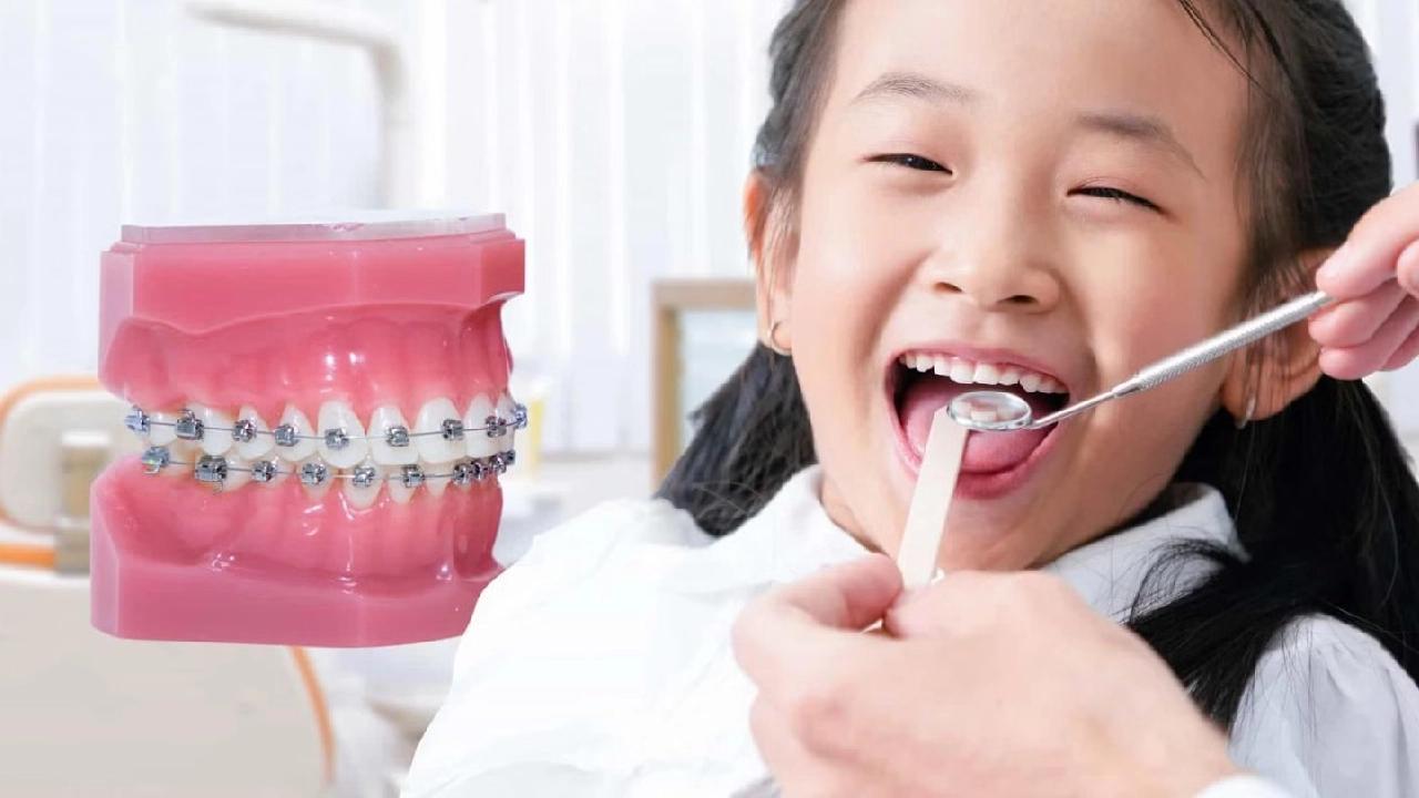 Niềng răng ở đâu uy tín? Những yếu tố quyết định kết quả chỉnh nha lâu dài